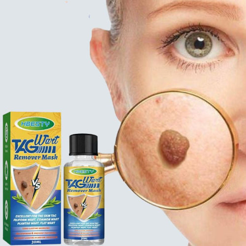 Serum elimination de verrues naeviques