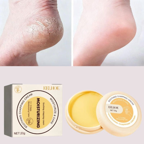 creme anti crevasses
