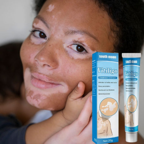 creme vitiligo