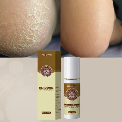 soins des pieds spray antifongique