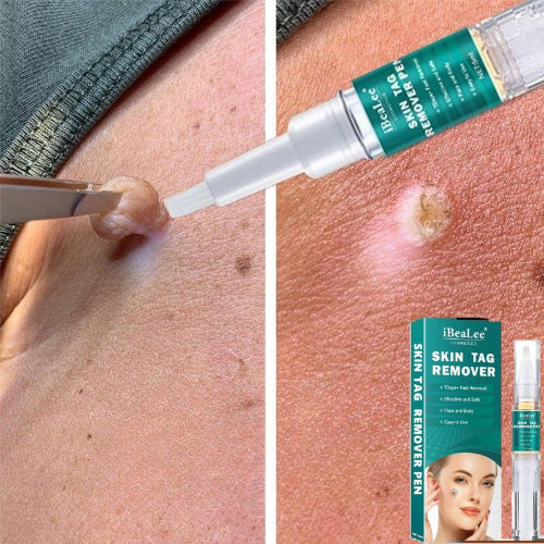 stylo anti verrues a base de trefle